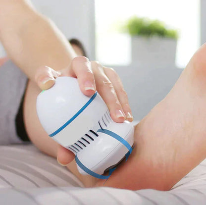 Luméva Vacuum Callus Remover